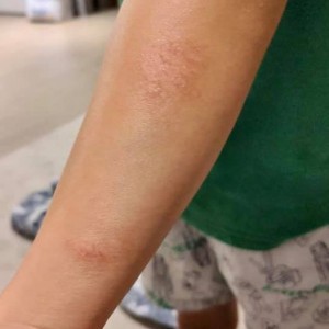 乾燥的季節, 皮膚護理篇